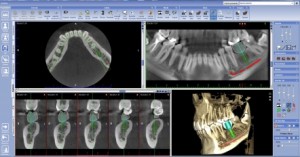 Radiología 3D
