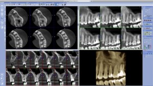 Radiología 3D